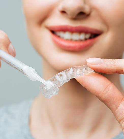 Close-up of woman filling in tray with teeth whitening gel