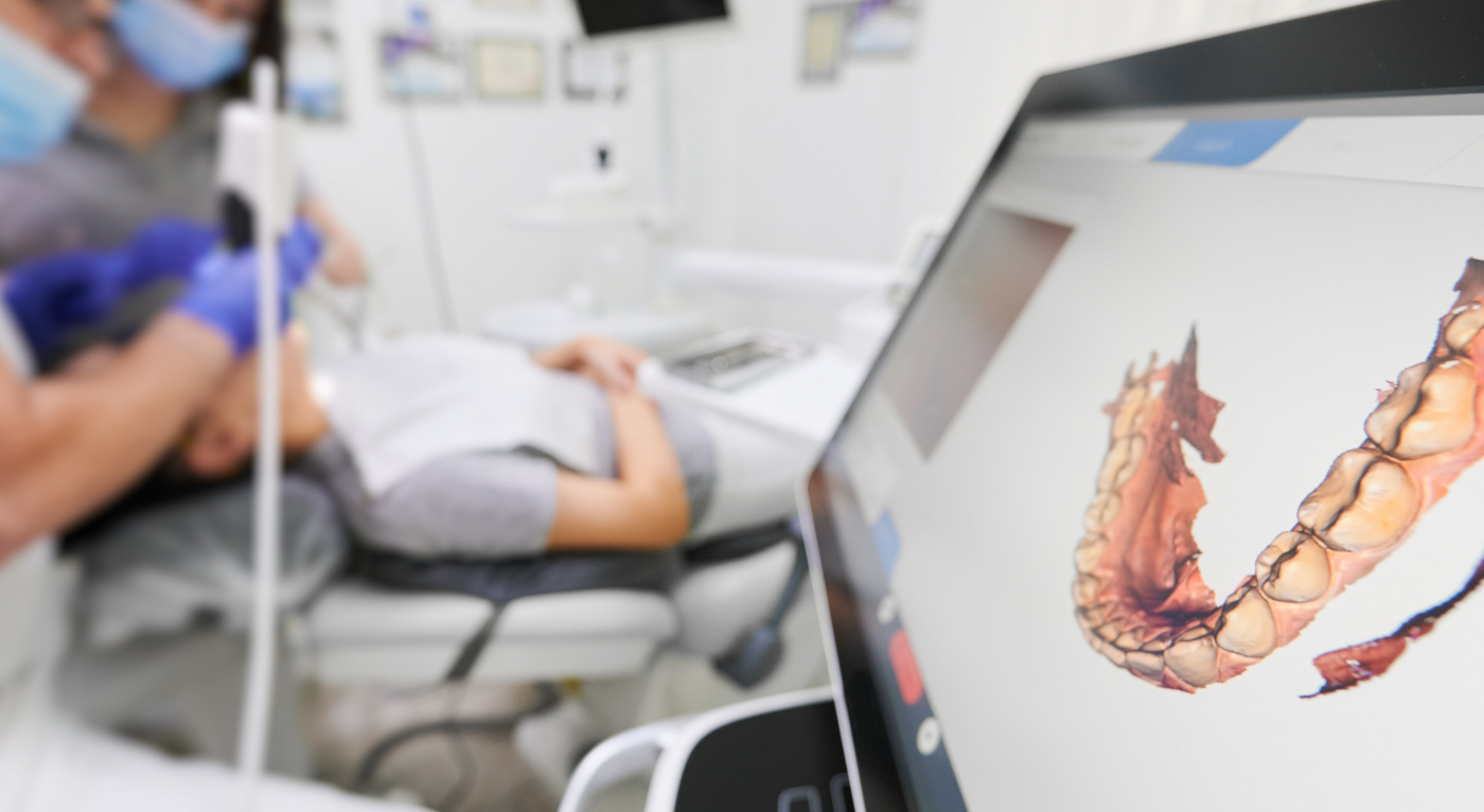 Image of teeth on a monitor