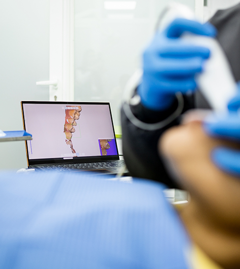 Dentist taking digital impression of teeth with results appearing on monitor in background