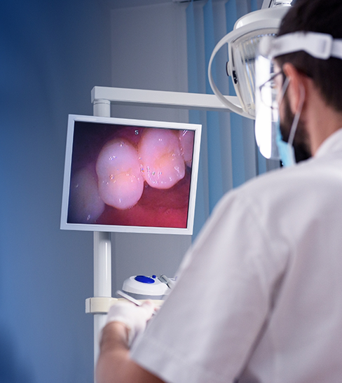 Dentist looking at teeth on screen using intraoral camera