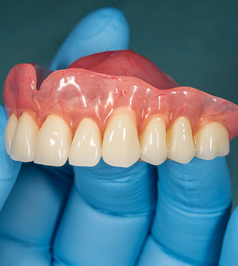 Close-up of gloved hand holding a full denture